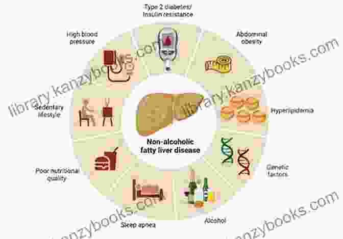 Fatty Liver Risk Factors THE FATTY LIVER CURE COOKBOOK: Simple And Healthy Recipes For Detoxification And Regeneration Of The Liver